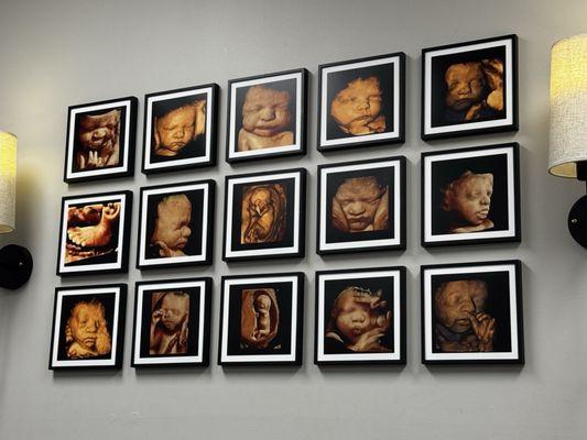 Bump Life 4D Ultrasound Studio