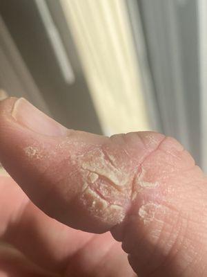 Premier Dermatology and Mohs Surgery of Atlanta