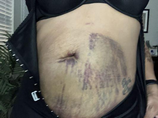 My results after my "massage". It was NOT like this before.