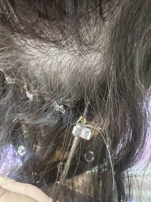 Damage and bald spots from botched extensions done by Abbey Martinez @ Beauty Designz by Abbs