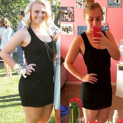 Before and fter one round of HCG injections