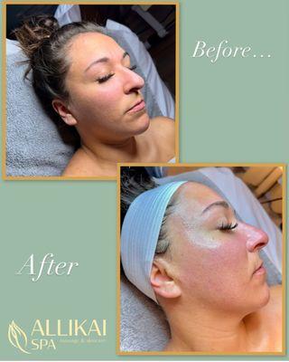 ALLIKAI SPA