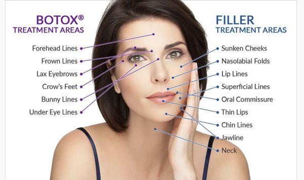 Treatment differences between Relaxers and Fillers.