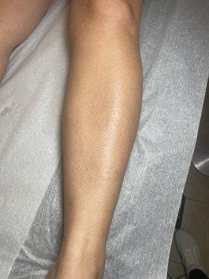 Leg waxing (after)