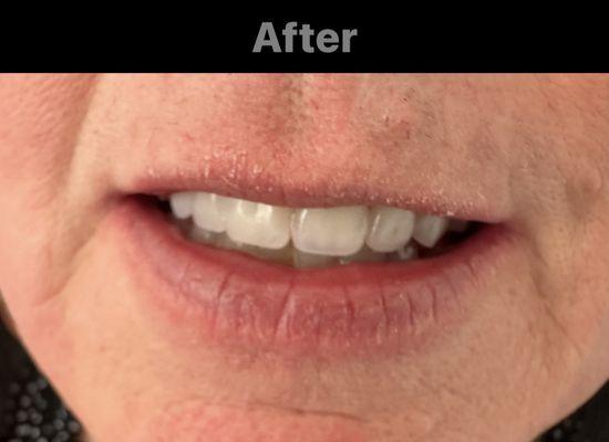 Advanced Denture Care Center