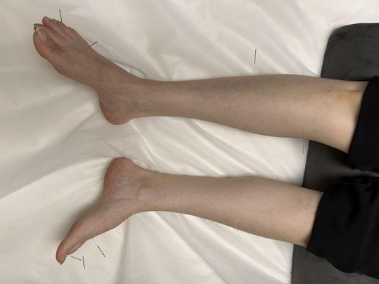 immune system boost, stress relief points