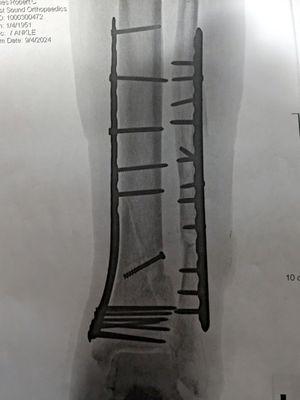 Franciscan Orthopedics - Silverdale