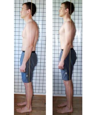 Client's posture before and after YogAlign session.
For class schedule: www.YogAlignLA.com