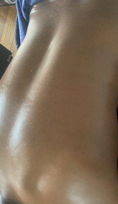 Back treatment (massage) finished look.