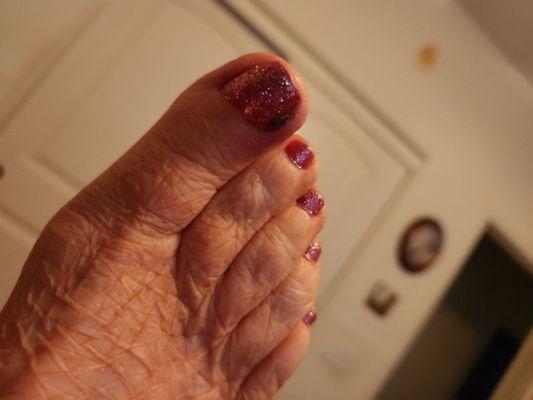 Don't go here. I gotta infection when to doctor photo infection with in 2 days. Dirty nippers the water is in a bag so it can't be that