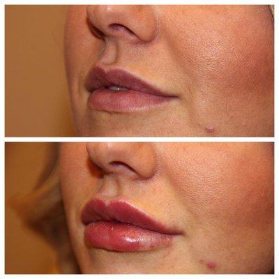 Frontier Dermatology Aesthetics