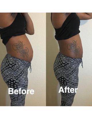 #bodysculpting #weightloss #mealplan #contouring #bodycontour #bodycontouringhouston #houstonbodycontouring #bodycontouring