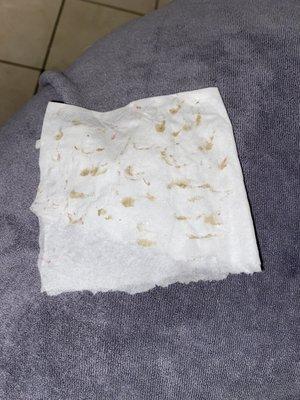 The pore extraction painful but satisfying, and afterwards my face is bumpless and purified!