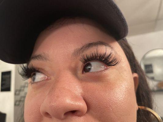 Embo Elite Esthetics