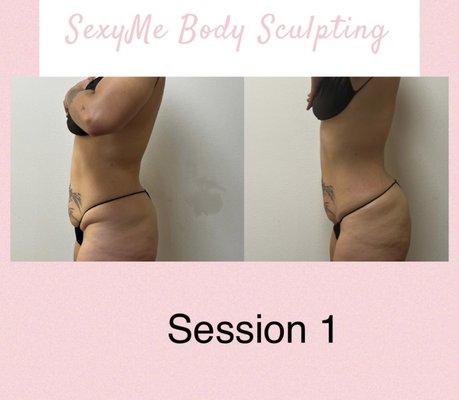 SexyMe Body Sculpting