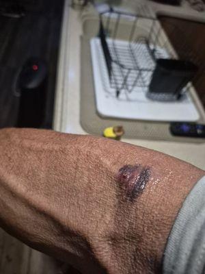 BioLife Plasma Services