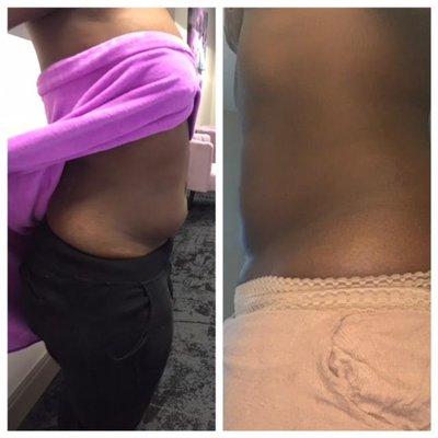 Prestige Aesthetics & Body Sculpting