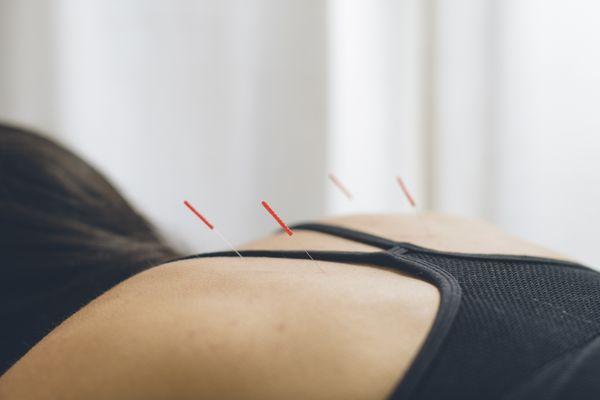 Cindi Ignatovsky, DACM LAc