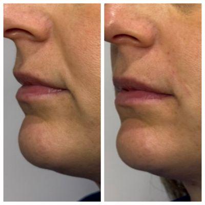 Your Laser Skin Care