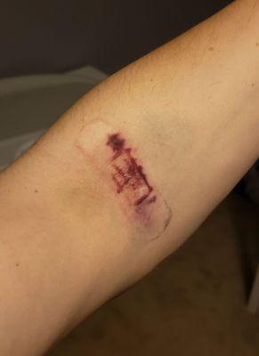 Vitalant Blood Donation- Naperville