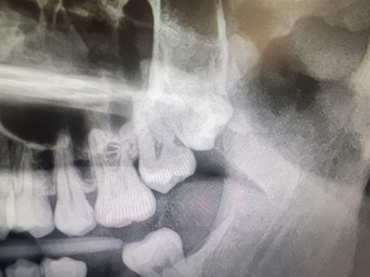 Valley Dental Surgery & Implant Center