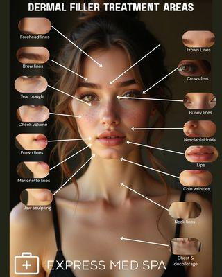 Express Med Spa - Frankfort