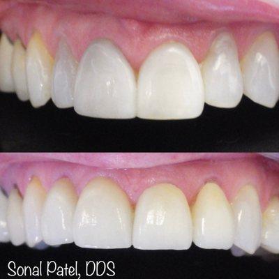 Sonal Patel, DDS