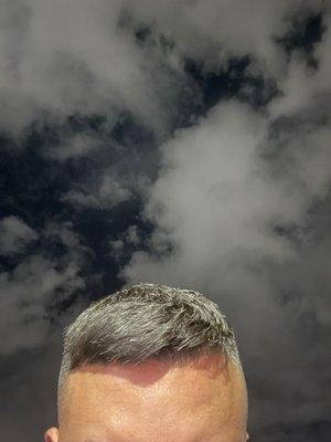 my head looks deformed now