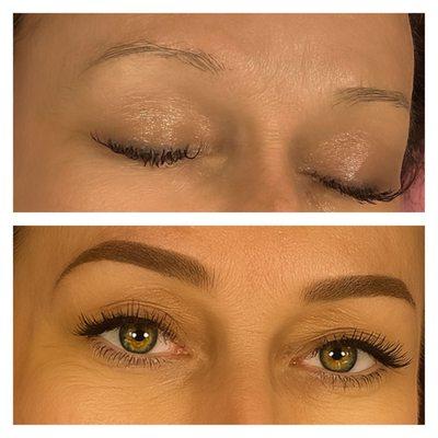 This was me back in the day, my first time before and after.