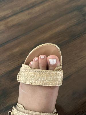 the chipped nail and cuticles grown back