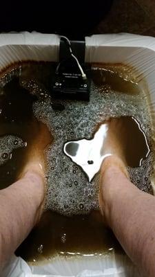 Detox ion clense---Toxins from my body