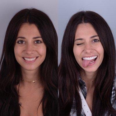 Nader Yermian, DDS - Vicente Dental