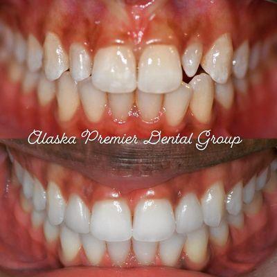 Alaska Premier Dental Group