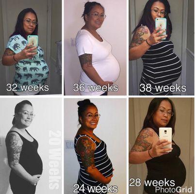 Options In Conception