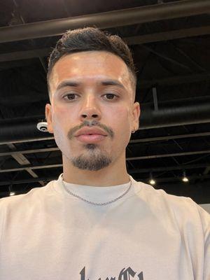 After the PRP facial