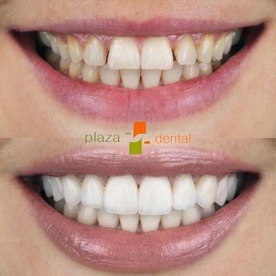 Plaza Dental