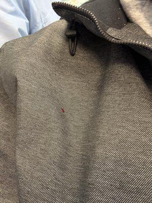 He was flinging my blood everywhere from my mouth