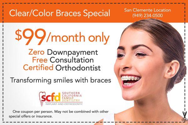 braces for $99 monthly
no down payment