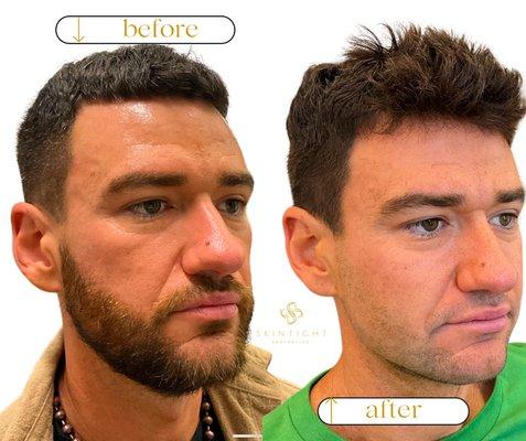 SkinTight Aesthetics