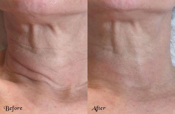 PDO Threads for necklines