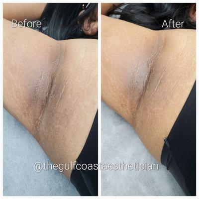 Skin Correction