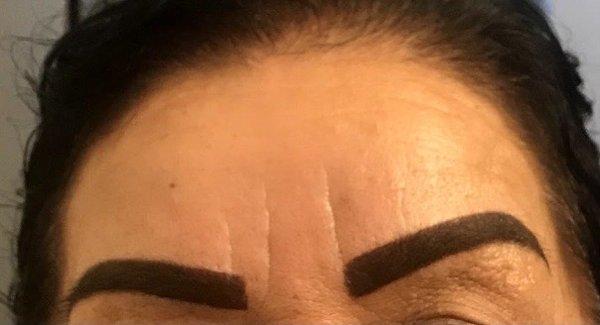 Microblading gone wrong