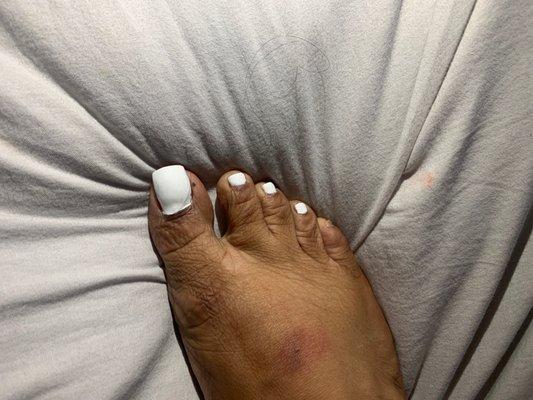The cuticles...  I paid 16 extra dollars for polish that came off the day of smh 