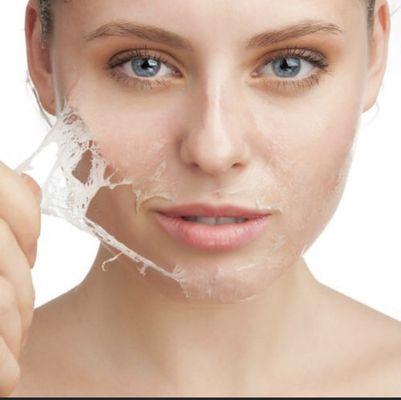 Chemical peel