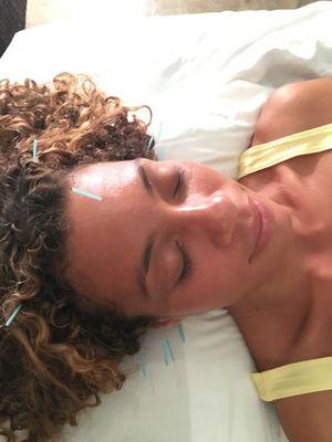 Honolulu, Oahu Acupuncture