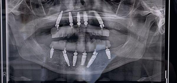 Smart Dental & Implant Center