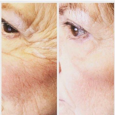 Revive hair and skin restoration