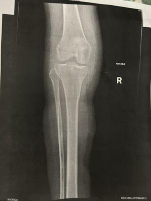 Everett Bone & Joint