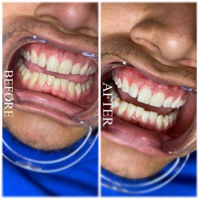 ️The Sweet Spot️