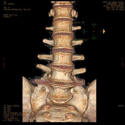 The Advanced Spine Center